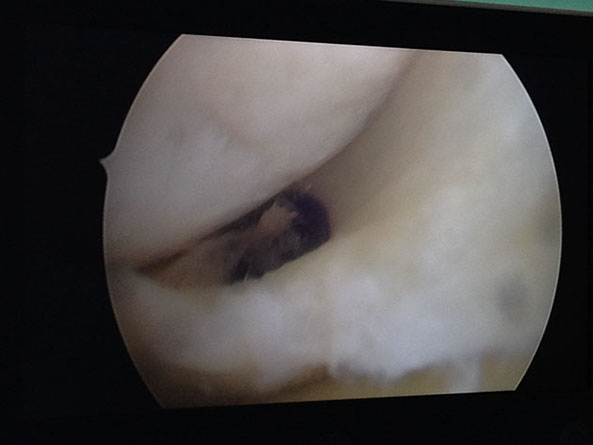 Залавин Владимир Геннадьевич. Челябинск. Врач травматолог-ортопед. Операция сустав. Операционная.