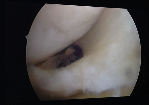 Залавин Владимир Геннадьевич. Челябинск. Врач травматолог-ортопед. Операция сустав. Операционная.