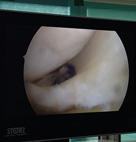 Залавин Владимир Геннадьевич. Челябинск. Врач травматолог-ортопед. Операция сустав. Операционная.