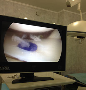 Залавин Владимир Геннадьевич. Челябинск. Врач травматолог-ортопед. Операция сустав